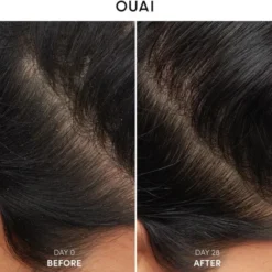Anti-Dandruff Shampoo