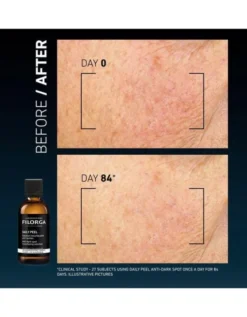 Clinical Home Peel Dark Spot 50 ml