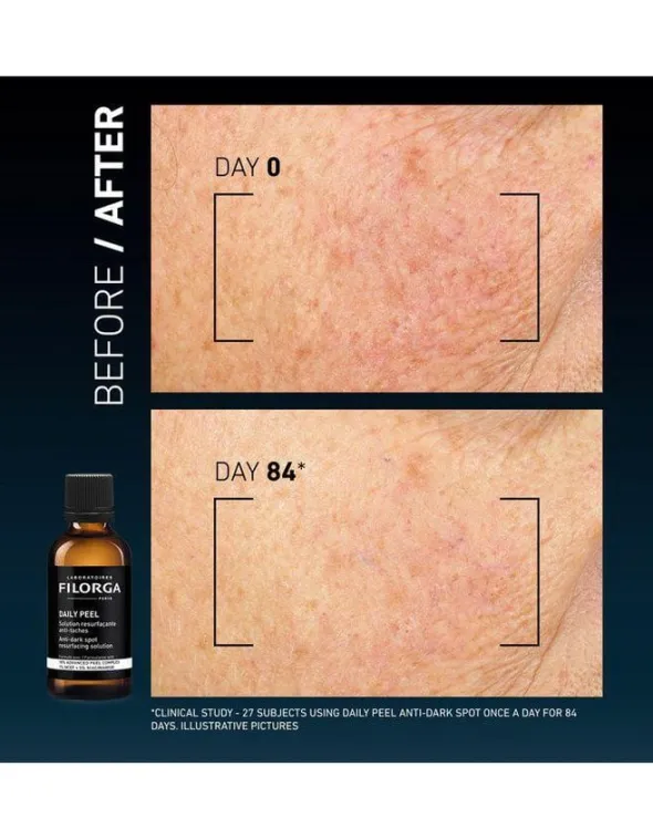 Clinical Home Peel Dark Spot 50 ml