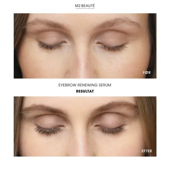 Eyebrow Renewing Serum 5 ml.
