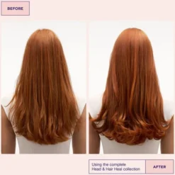 Head & Hair Heal Conditioner 300ml