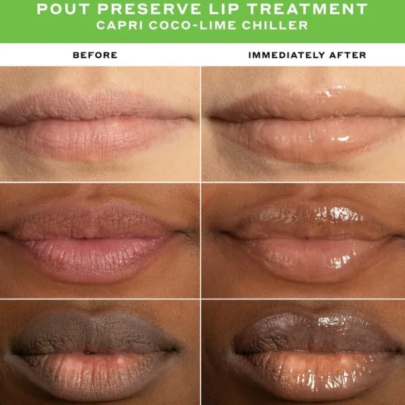 LIP TREATMENT