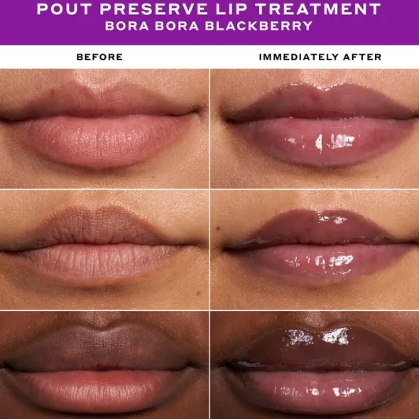 LIP TREATMENT