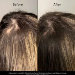 Pitta Growth Serum - Tillväxtserum