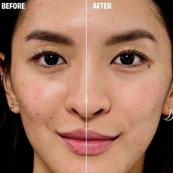 Porefessional Primer