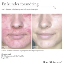 Raz Skincare Cleansing Mask 200 g