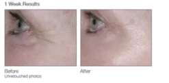 Renewing Eye Cream