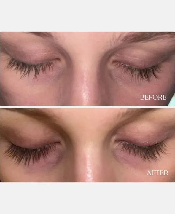 Vippeserum