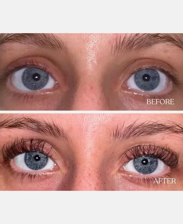 Vippeserum