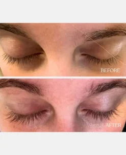 Vippeserum